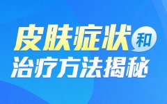 郑州肤康皮肤病医院解答脱发严重